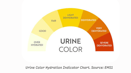 Urine colour